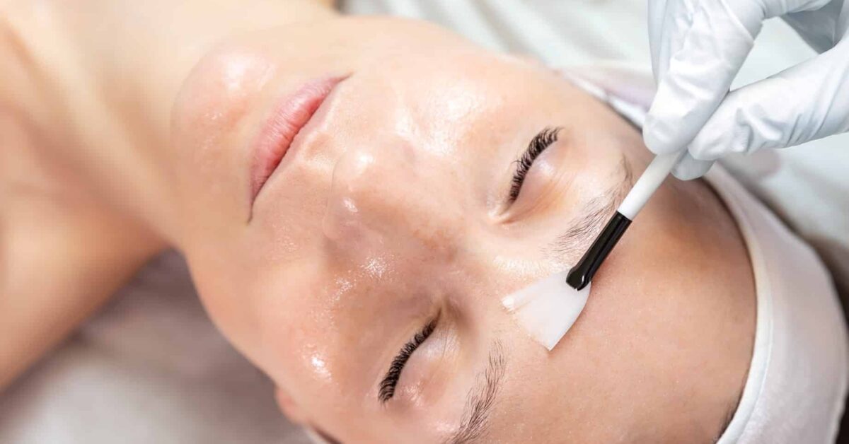 Close up of a woman’s face as she lies on her back with her eyes closed and a gloved hand brushes a chemical peel product onto her skin.